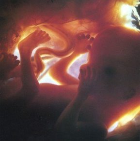 L'échographie L'échographie