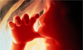 L'échographie L'échographie